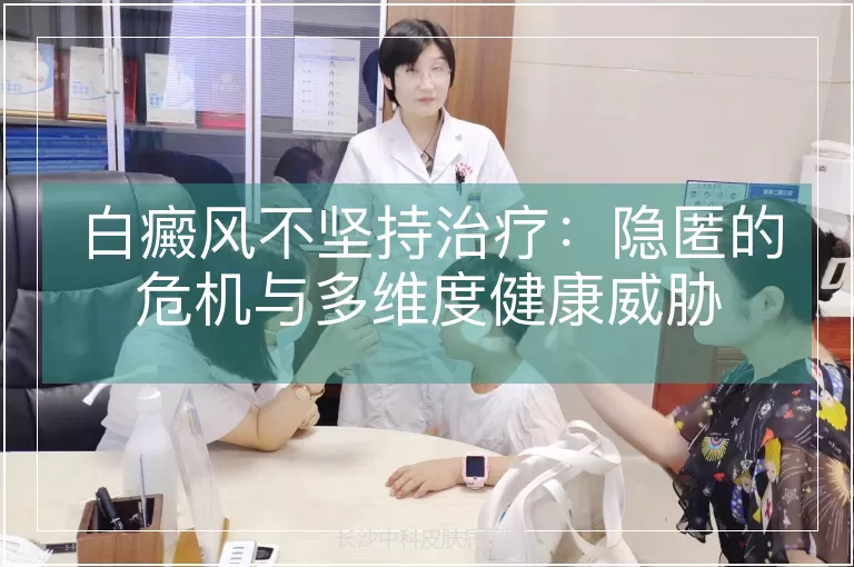 白癜风不坚持治疗：隐匿的危机与多维度健康威胁