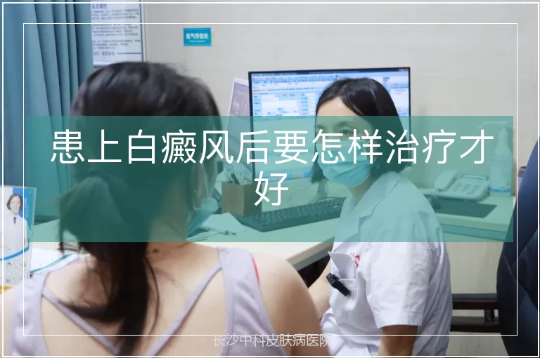 患上白癜风后要怎样治疗才好