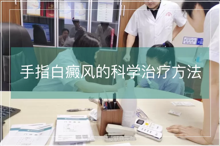 手指白癜风的科学治疗方法