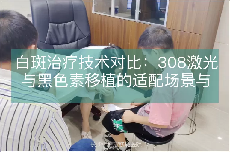 白斑治疗技术对比：308激光与黑色素移植的适配场景与疗效解析