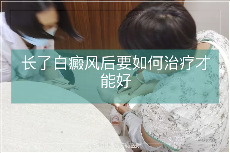 长了白癜风后要如何治疗才能好