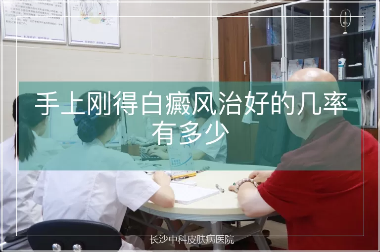 手上刚得白癜风治好的几率有多少