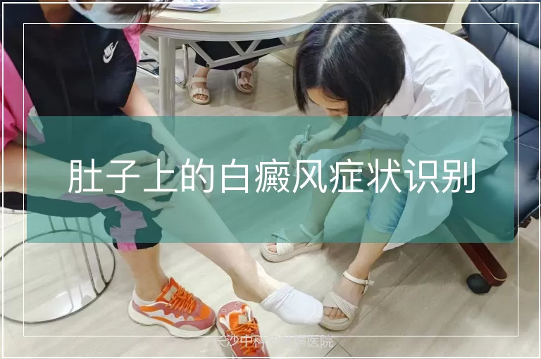 肚子上的白癜风症状识别