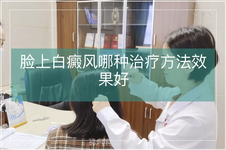 脸上白癜风哪种治疗方法效果好