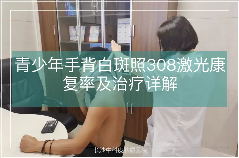 青少年手背白斑照308激光康复率及治疗详解