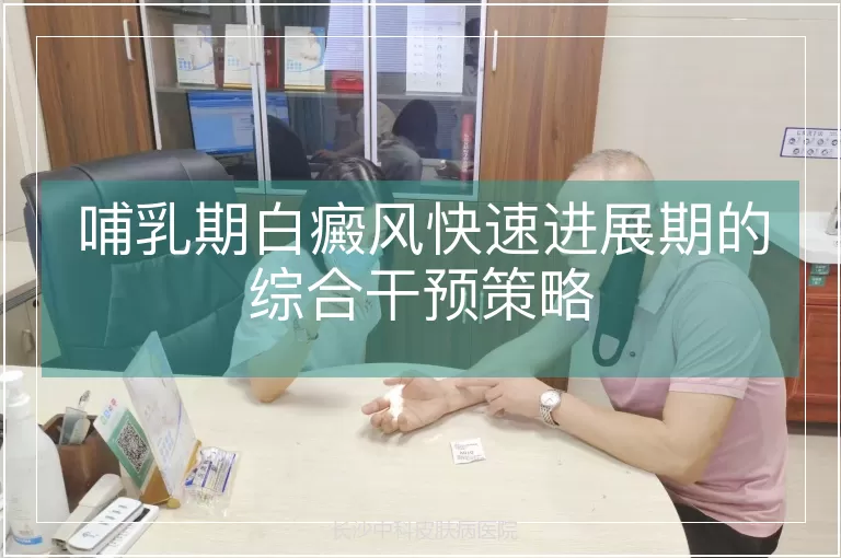 哺乳期白癜风快速进展期的综合干预策略