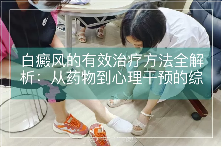 白癜风的有效治疗方法全解析：从药物到心理干预的综合策略