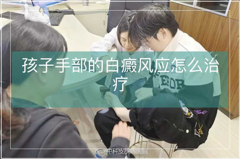 孩子手部的白癜风应怎么治疗