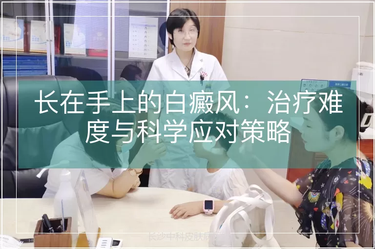 长在手上的白癜风：治疗难度与科学应对策略