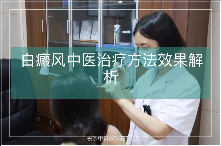 白癜风中医治疗方法效果解析