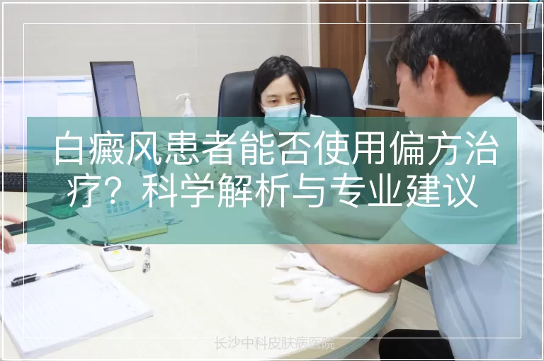 白癜风患者能否使用偏方治疗？科学解析与专业建议