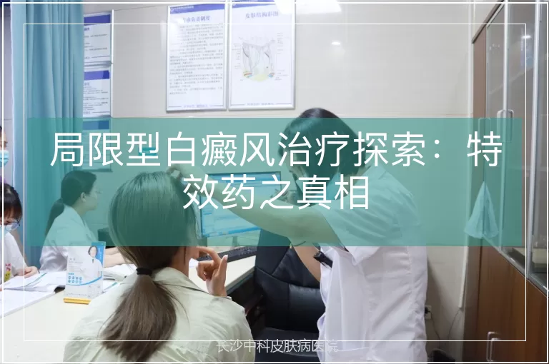 局限型白癜风治疗探索：特效药之真相