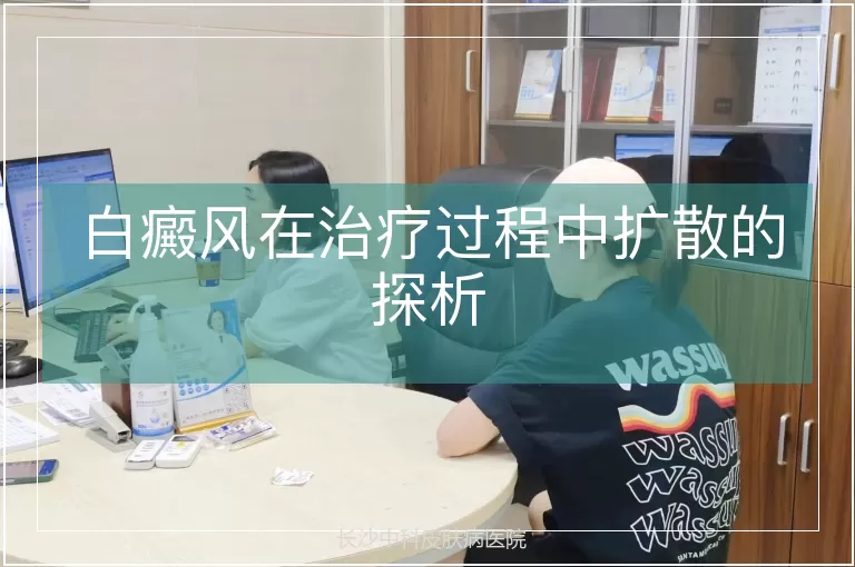 白癜风在治疗过程中扩散的探析