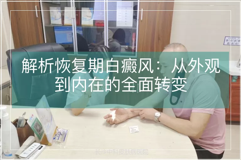 解析恢复期白癜风：从外观到内在的全面转变