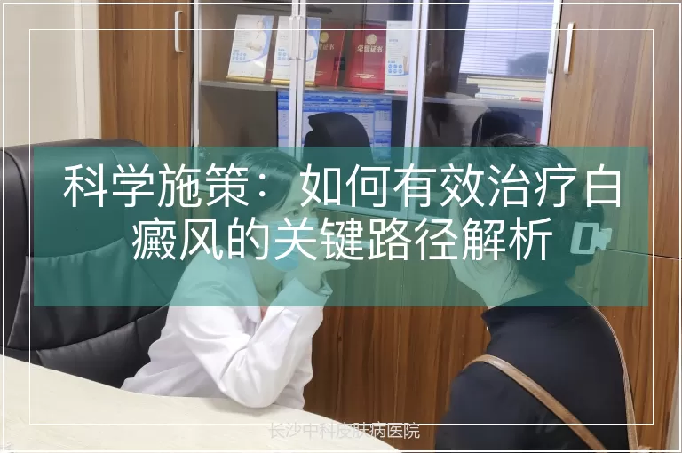 科学施策：如何有效治疗白癜风的关键路径解析