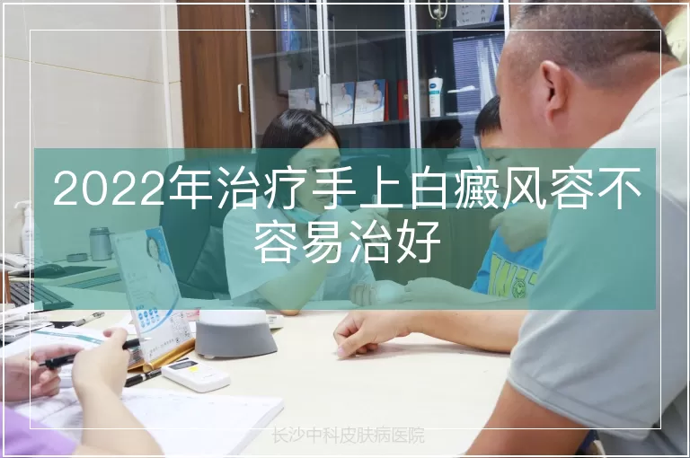 2022年治疗手上白癜风容不容易治好