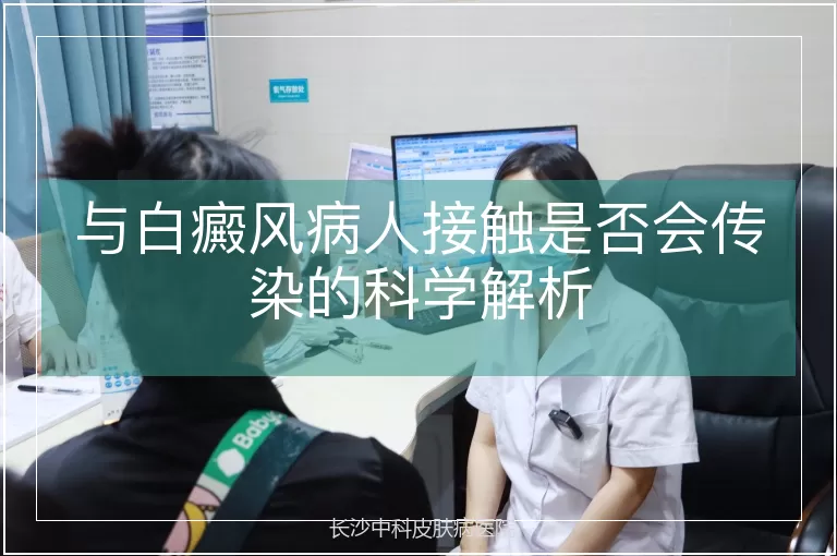 与白癜风病人接触是否会传染的科学解析