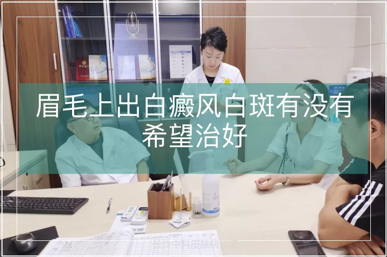 眉毛上出白癜风白斑有没有希望治好