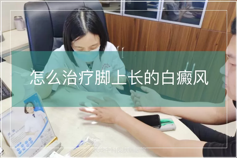 怎么治疗脚上长的白癜风