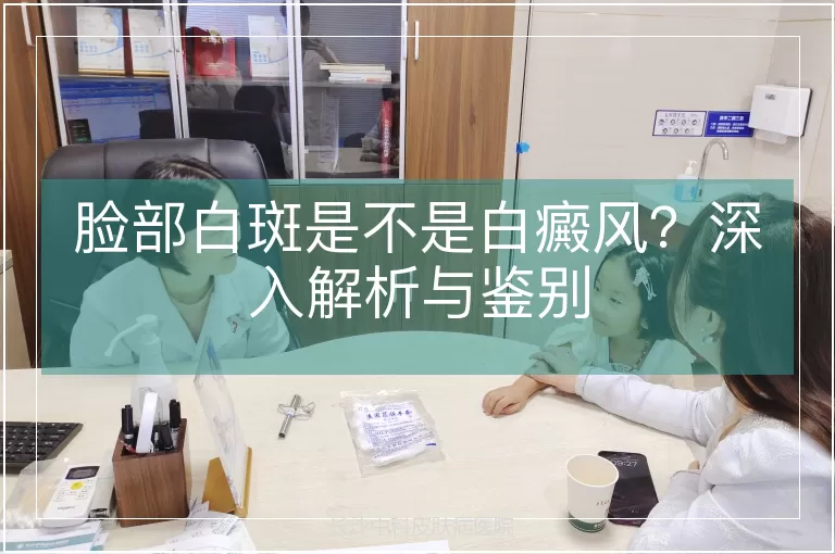 脸部白斑是不是白癜风？深入解析与鉴别