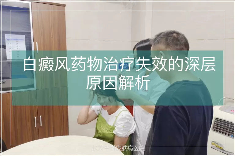 白癜风药物治疗失效的深层原因解析