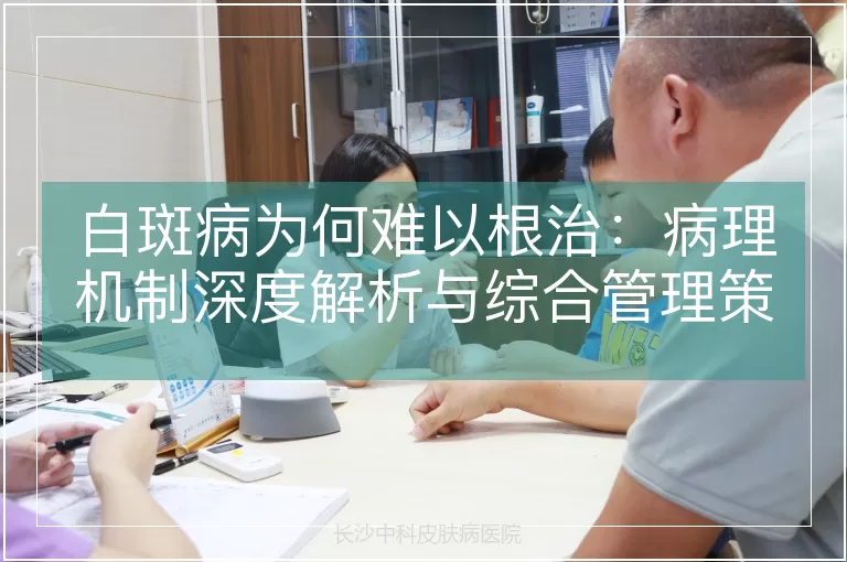白斑病为何难以根治：病理机制深度解析与综合管理策略