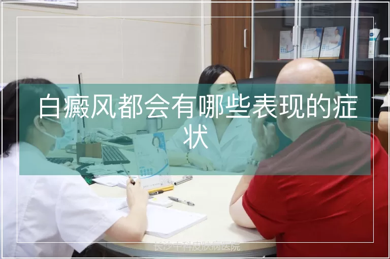 白癜风都会有哪些表现的症状